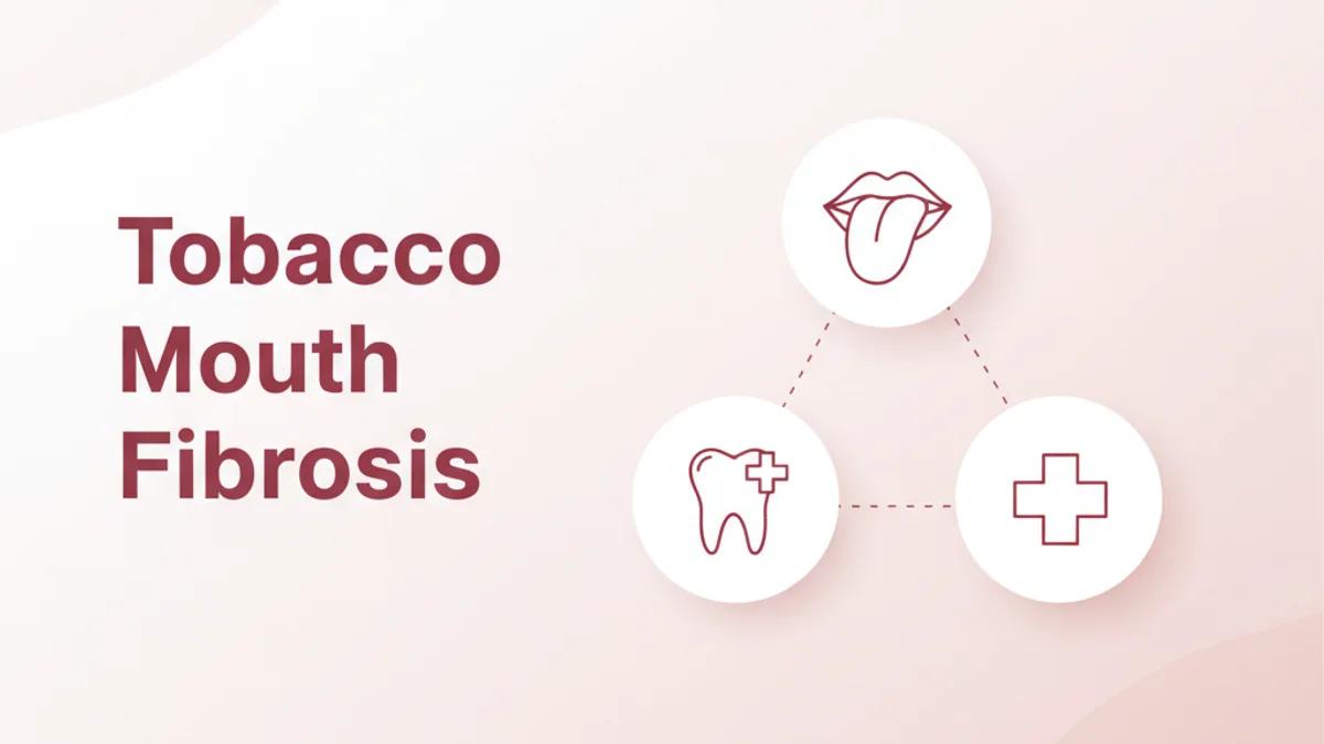 Oral Submucous Fibrosis Treatment Chennai - Dr Vidhyadharan